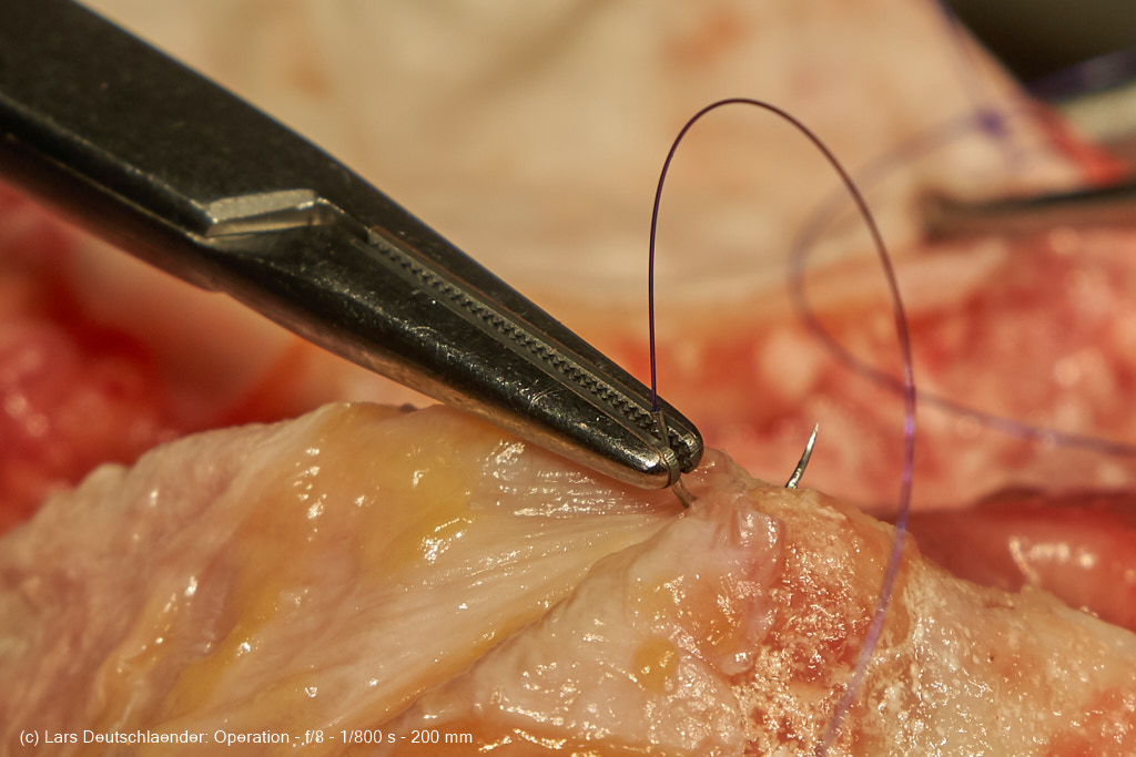 Operations Fotografie 3