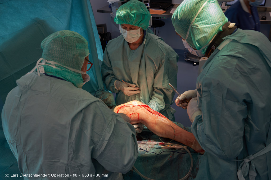 Operations Fotografie 4